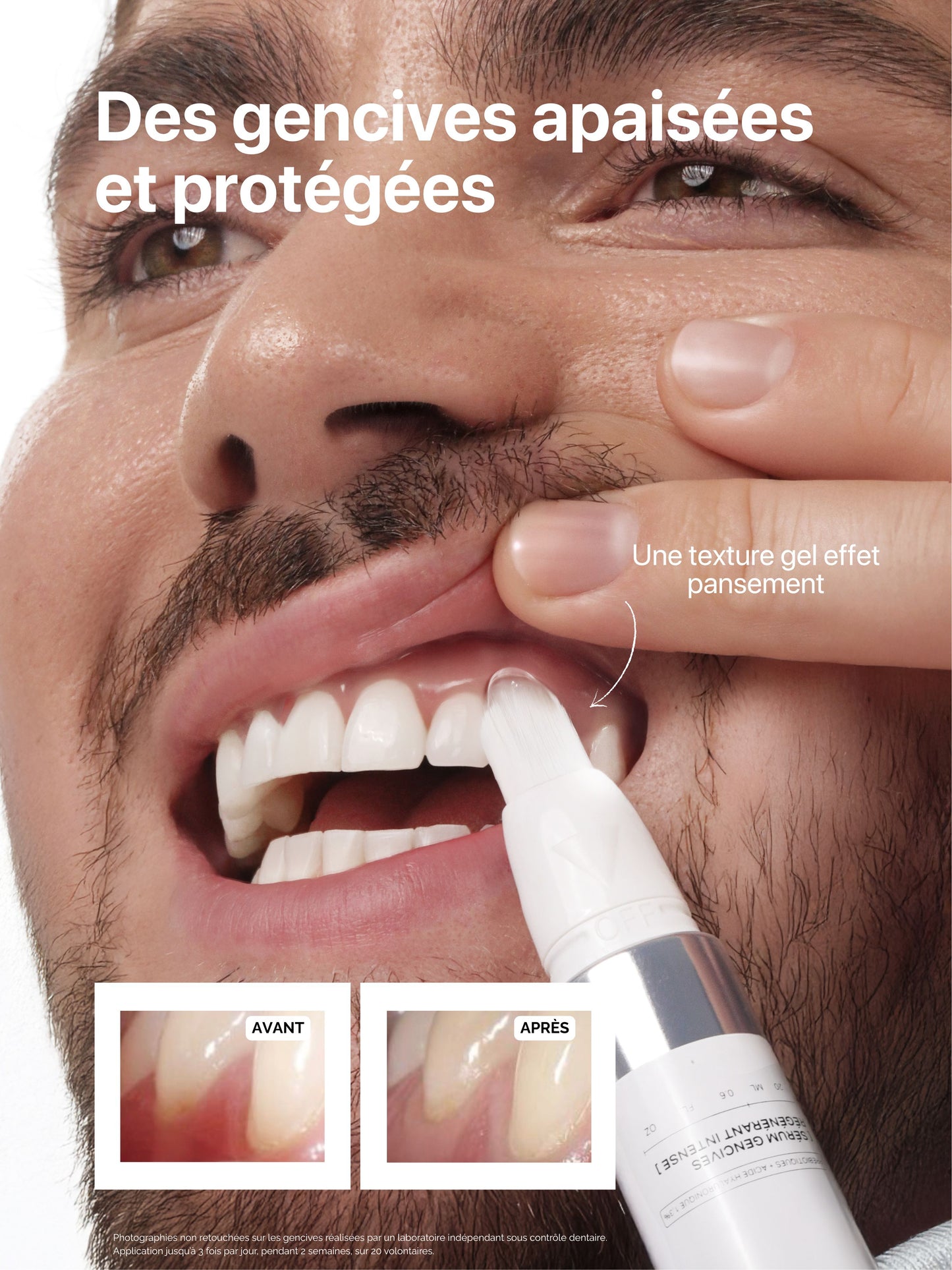 Kit Soothing Gum
