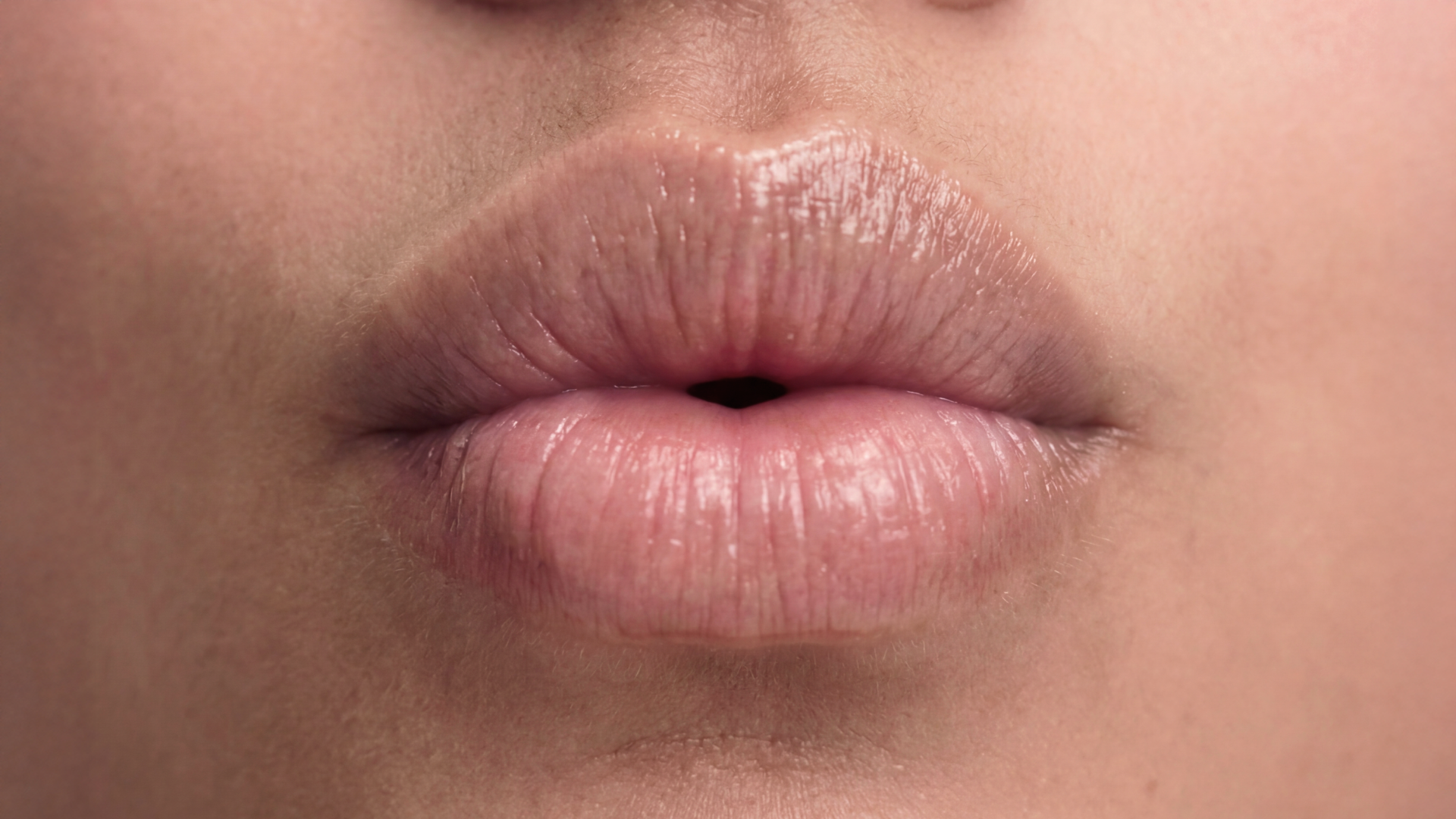 Bad breath: how to get rid of it permanently and naturally?